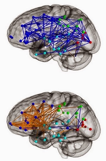 Male and Female Brain Wiring